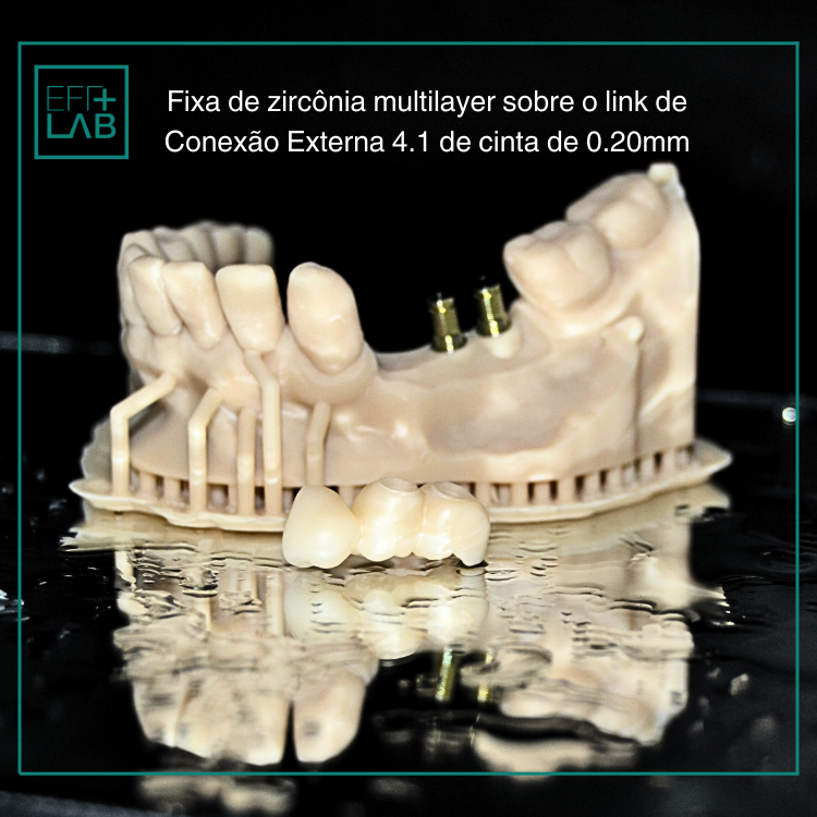 Zircônia (4)