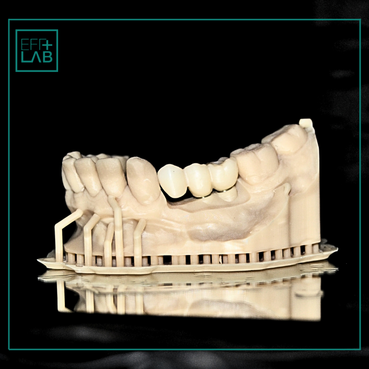 Zircônia (6)